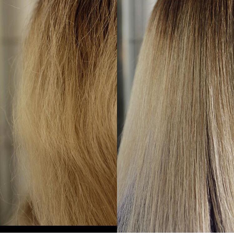 Before and After HeatCure Treatment